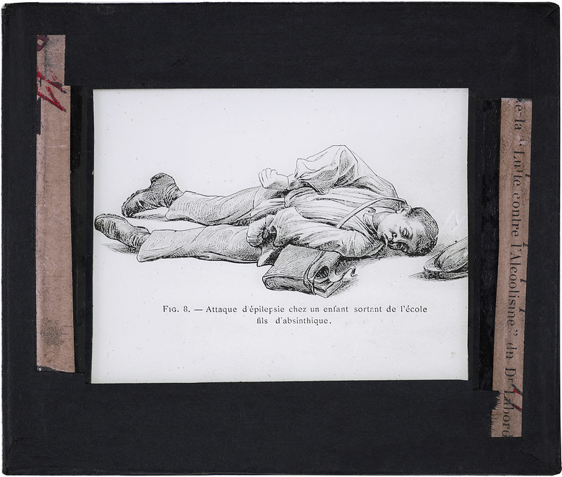 dessin montrant un élève allongé à terre. Ses membres sont desaxés. Un liquide sort de sa bouche. Il est écrit "attaque d'épilepsie chez un enfant sortant de l'école. Fils d'absinthique.
